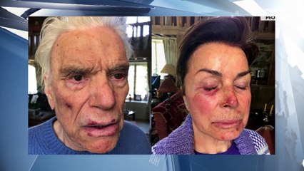 Bernard Tapie cambriolé : ses rares confidences après son agression