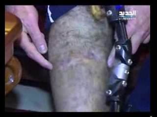 جرحى الانفجارات - ليال بو موسى