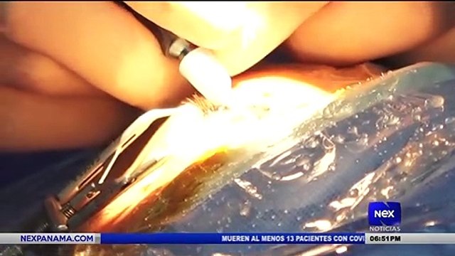 Realizan las primeras operaciones de cataratas - Nex Noticias
