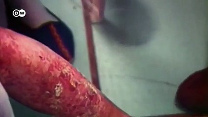 Chernóbil   35 años después del desastre nuclear    DW Documental