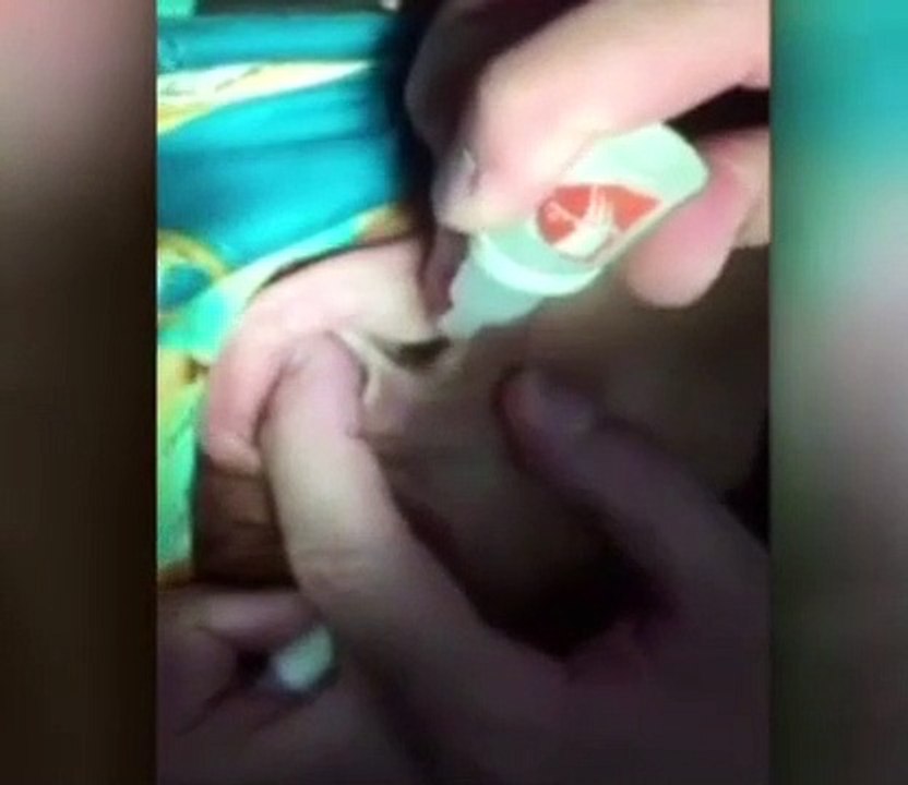 Kulağından kırkayak çıktı