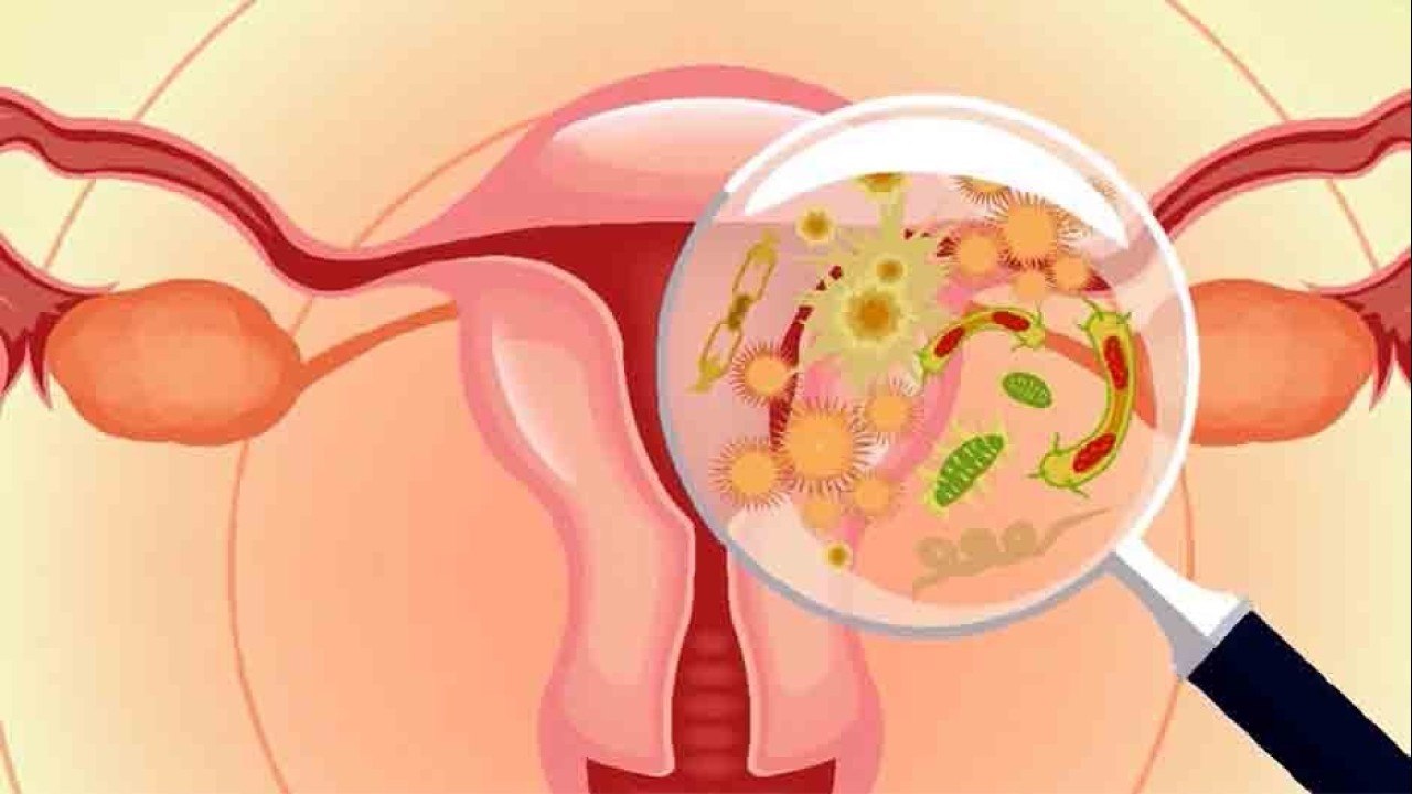 bd-infecciones-vaginales-280421