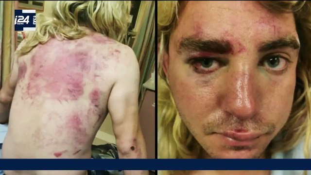 Jérusalem: Les images hyper violentes d'un jeune Israélien attaqué par des Palestiniens en pleine rue provoquent une vive émotion (attention vidéo très dure)