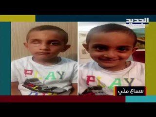 كل ما تريد معرفته عن العين الصناعية أنواعها وكيفية تصنيعها مع الطبيب محمود حكيم