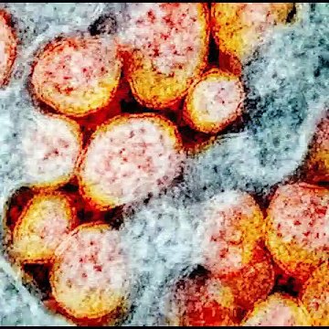 #Covid19Updates, Karnataka: ರಾಜ್ಯದಲ್ಲಿ ಇಂದು 39047 ಜನರಿಗೆ ಸೋಂಕು | Oneindia Kannada