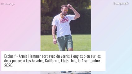 Download Video: Armie Hammer dans la tourmente : de lourds secrets de famille bientôt dévoilés...