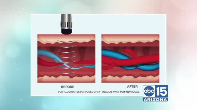 Andrew Rinehart of Camelback Medical explains how ED affects relationships