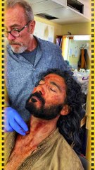 أشهر إصابات حدثت للفنانين أثناء التصوير