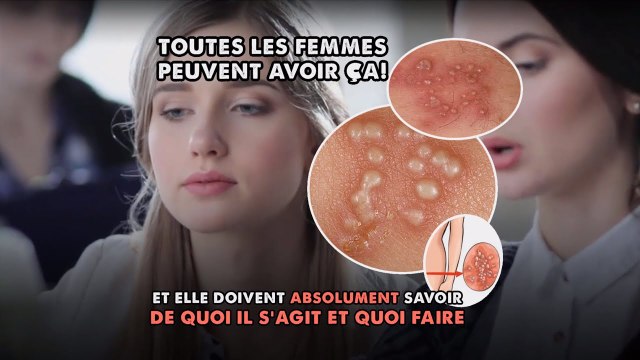 Toutes les femmes peuvent avoir ça et elles doivent absolument savoir ce que c’est et quoi faire..