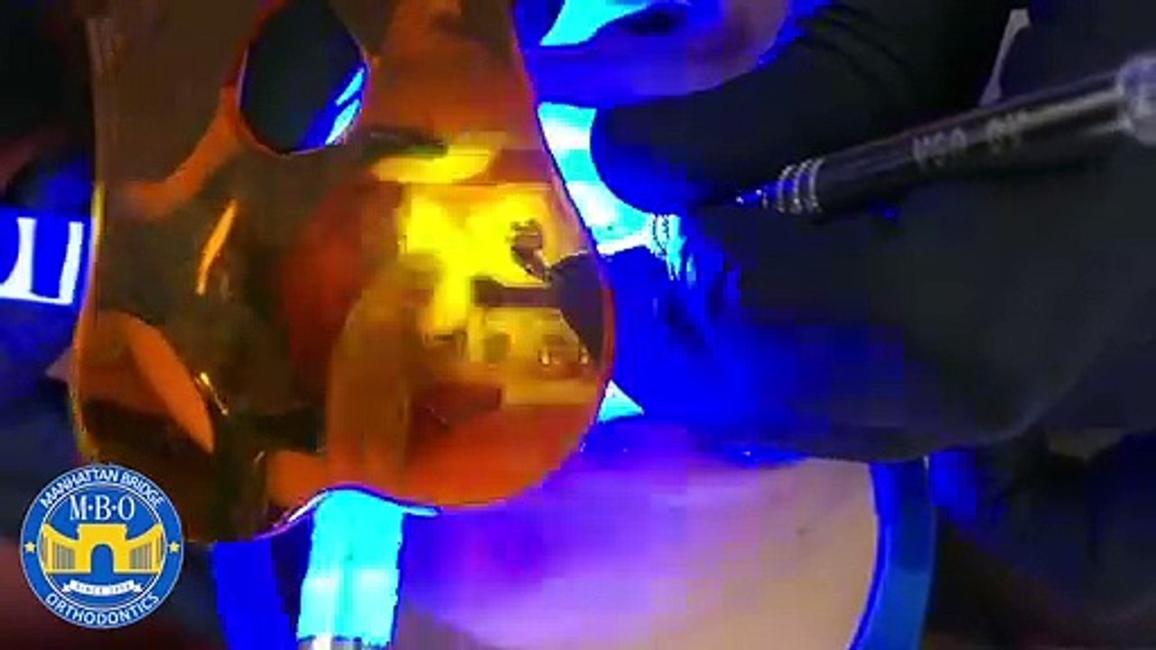 Process Of Getting Braces