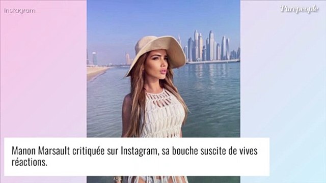 Manon Marsault, ses lèvres mal refaites : elle regrette et fait machine arrière
