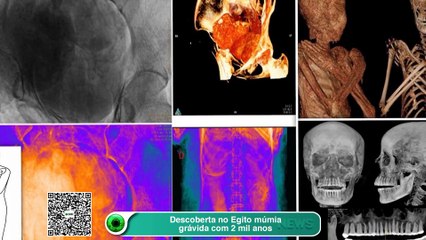 Descoberta no Egito múmia grávida com 2 mil anos