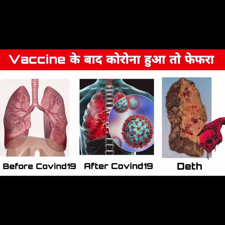 Coronavirus India Update : कोविड वैक्सीन पर नया अपडेट ||coronavirus update || कोविड 19 ||