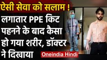 Viral Photo:  घंटों तक PPE किट पहनने के बाद Doctors का हाल । वनइंडिया हिंदी
