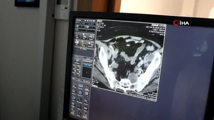 Nadir görülen hastalıktan doktoru sayesinde kurtuldu