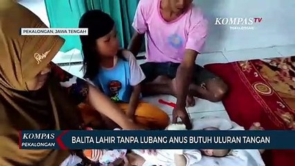 Balita di Pekalongan Lahir Tanpa Lubang Anus