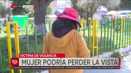 Envían a la cárcel a policía acusado de agredir a su exesposa, la mujer podría perder la visión de un ojo