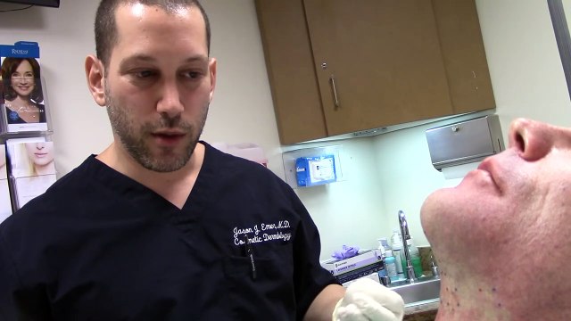 Kybella (Deoxycholic Acid) For Submental/Unwanted Chin Fat Or Jawline Contouring Post-Liposuction