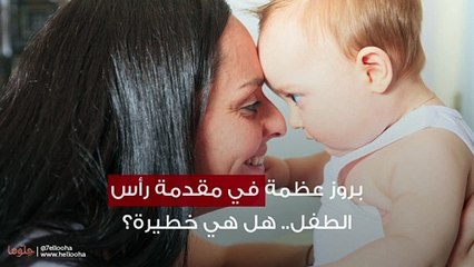 بروز عظمة في مقدمة رأس الطفل.. هل هي خطيرة؟