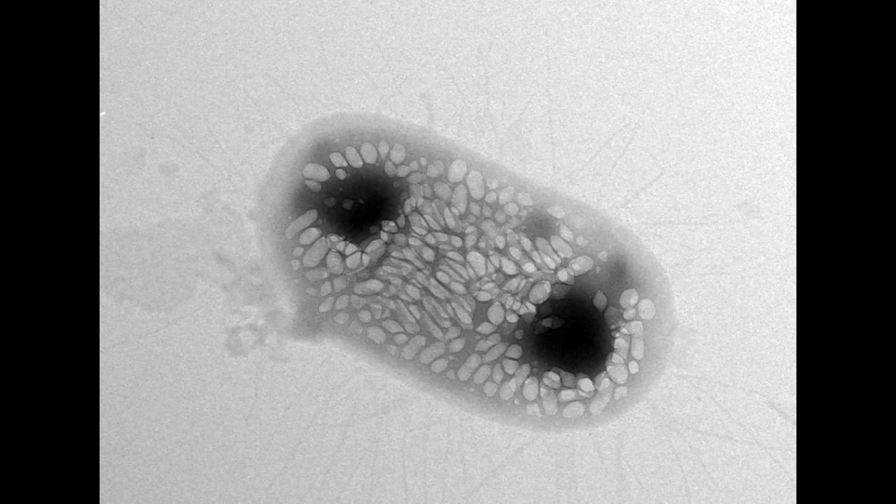 6, 62, 88, 44 Hz B Coli