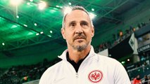 Angeschlagener FC Bayern? Hütter warnt, lässt sich aber 