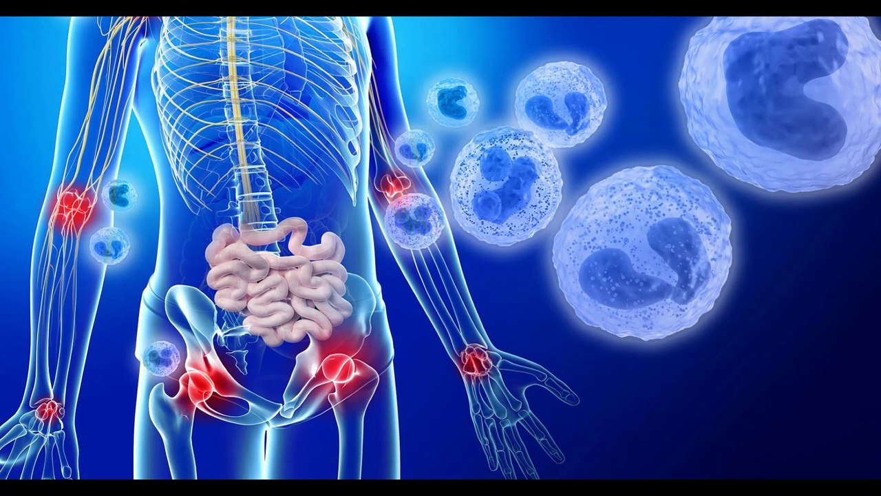 52, 55, 60, 78, 99, 147, 164Hz Arthritis, unspecified