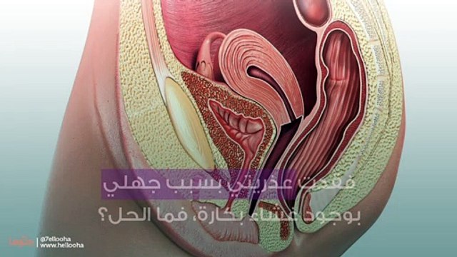 فقدت عذريتي بسبب جهلي بوجود غشاء بكارة، فما الحل؟