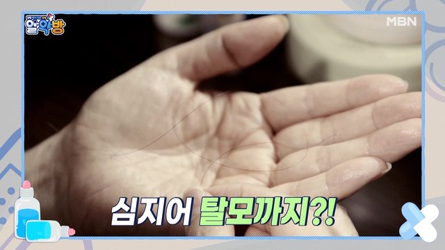 알약방 45회 [탈모와 무릎 통증까지! 모두 ‘이것‘ 부족하면 생기는 질환?!]