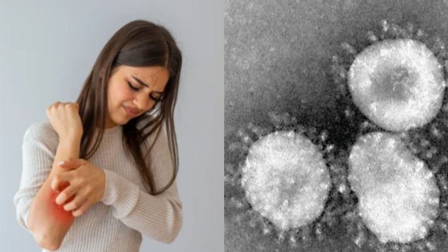 Corona Virus का New Symptom आया सामने, दिखें तो तुरंत हो जाए सावधान | Boldsky