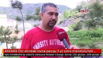 ANKARA Göz altındaki metal parçayı 3 yıl sonra mıknatısla fark etti