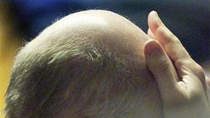 Corona Virus से आखिर क्यों है गंजे लोगों को ज्यादा खतरा | Corona Virus is Dangerous for Bald People