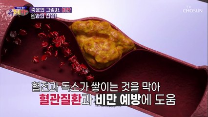 ‘혈중 콜레스테롤’ 감소 시켜주는 『대마종자유』 TV CHOSUN 20210509 방송