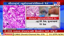 Over 659 cases of Mucormycosis in Saurashtra, special ward started at Rajkot Civil Hospital _TV9News