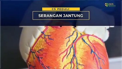 Serangan Jantung: Gejala Serangan Jantung Dan Ciri Ciri Serangan Jantung - Tips Kesehatan (2020)