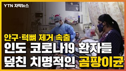 [자막뉴스] 안구·턱뼈 제거 속출...인도 코로나19 환자 덮친 곰팡이균 / YTN