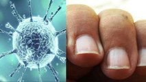 Corona Virus और आपके Nails का क्या है Relation, चौंका देगा सच | Boldsky