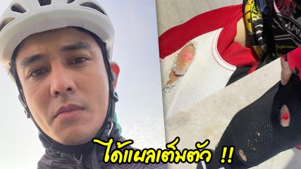 กัน นภัทร โชว์ปั่นจักรยานเสือหมอบวันแรก เกิดอุบัติเหตุมีแผลเต็มตัว แถมโดนแม่ด่าซ้ำ