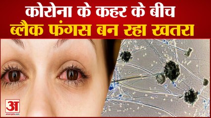 Coronavirus Pandemic के बीच Black Fungus or Mucormycosis बन रहा खतरा