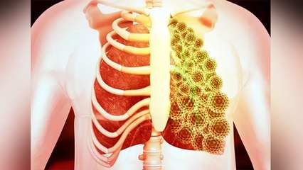 Malaika Arora ने बताया घर बैठे कैसे करें अपने फेफड़ों की जांच; Watch Video | Boldsky