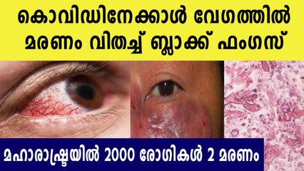Maharashtra May Have Over 2,000 Cases Of Black Fungus  | Oneindia Malayalamn