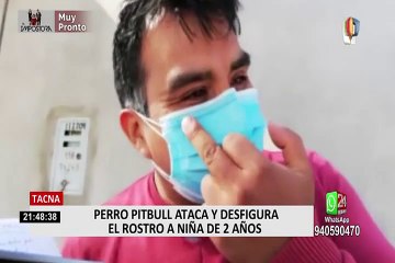 Tacna: perro pitbull ataca a niña de 2 años y familia pide que sea trasladada a Lima
