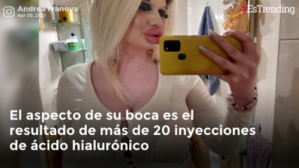 Ella es Andrea Ivanova, la mujer que busca tener los labios más grandes del mundo