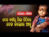 Special Story |  Puri Kid Suffers From Tumour Disease, Family Seeks Govt Help