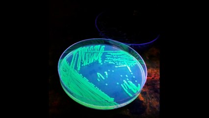 6, 62, 88Hz B, coli (E.coli)