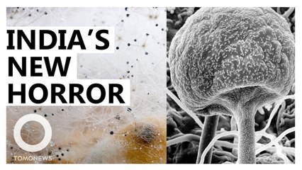 Deadly 'Black Fungus' Attacking Covid Survivors in India