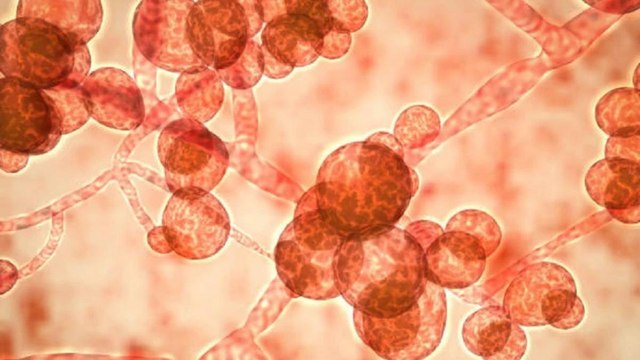 Medical experts on ‘black fungus’ infection