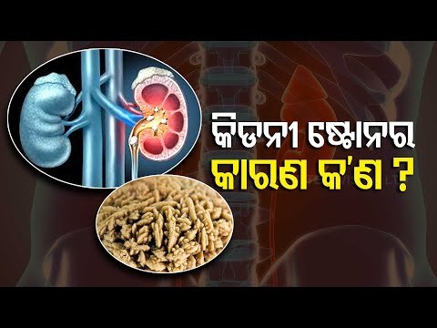 Kidney Stone | Causes, Symptoms & Treatment | Dr Biswajit Nanda Explains