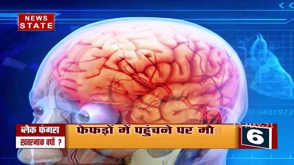 Chhatisgarh: राज्य में कोरोना के बाद अब ब्लैक फंगस का मंडराया खतरा