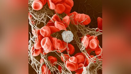 Corona Patient के Body में हो सकती है Blood Clotting, जानिए इसका इलाज । Boldsky