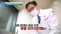 몸이 보내는 경고, 부종! 3초면 확인하는 자가 진단법